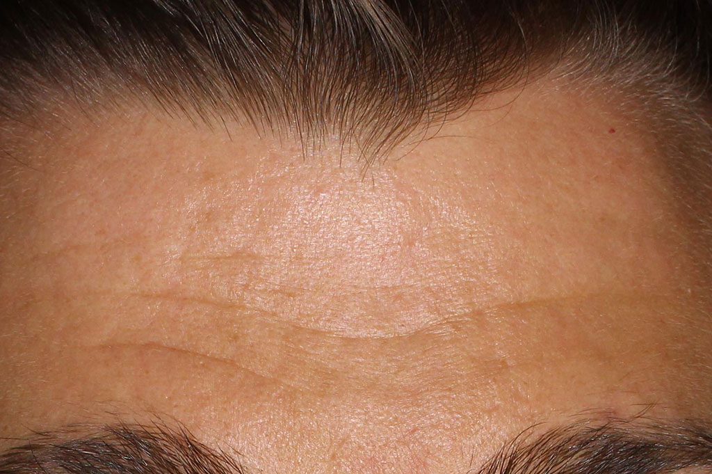 essential-moisture-boost-before